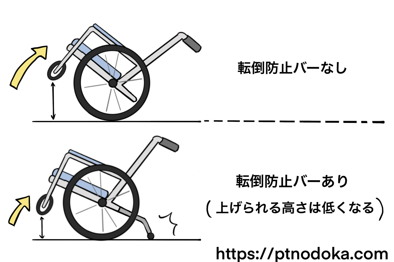 OX転倒防止バー オーエックス ウィリーバー 車椅子車いす車イス - 看護