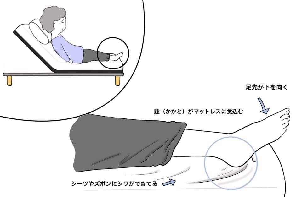 介助方法:背抜きのやり方「ベッドでモゾモゾ出来ない方に」 | のどかの医療と介護の資料館