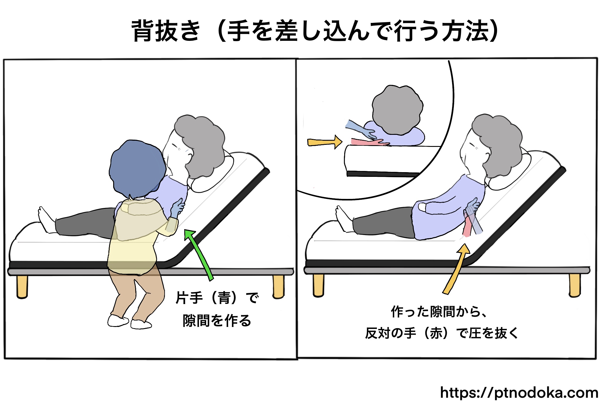介助方法:背抜きのやり方「ベッドでモゾモゾ出来ない方に」 | のどかの医療と介護の資料館