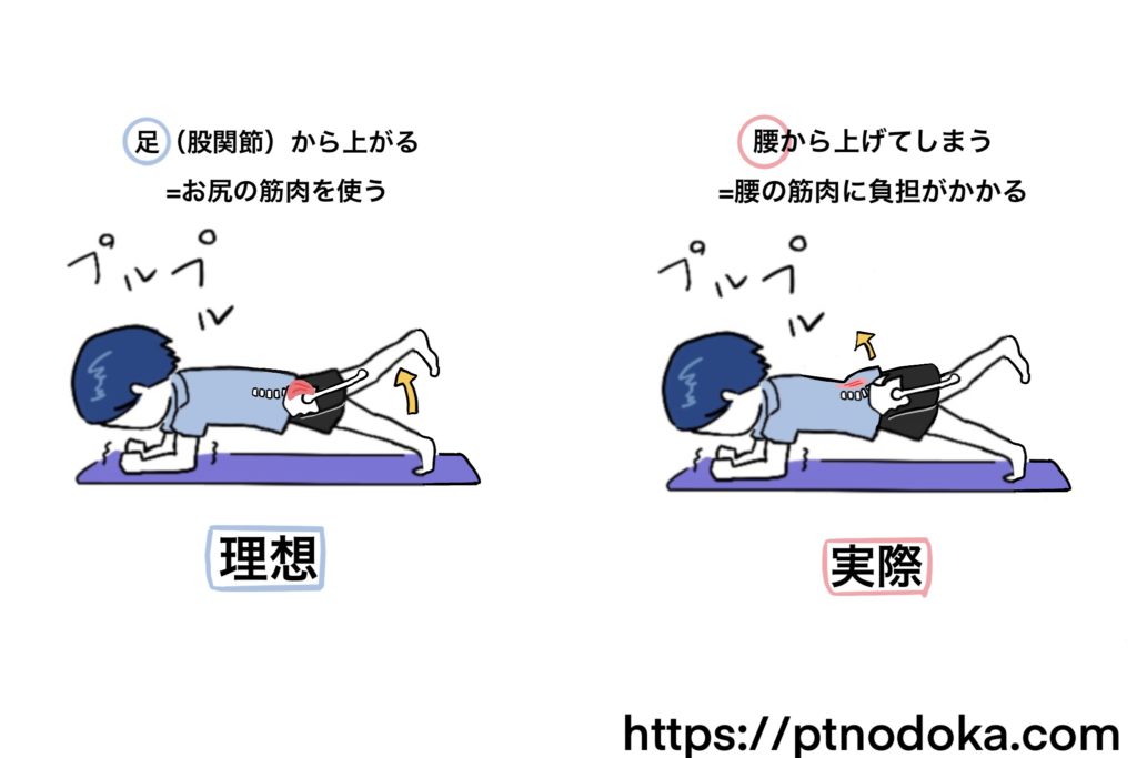 腰の筋肉の痛みの原因のイラスト